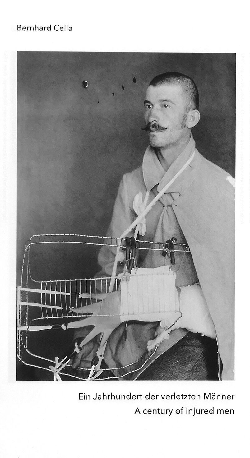 A Century of Injured Men